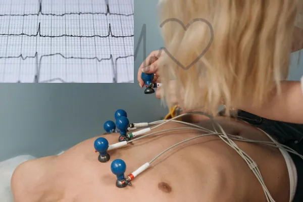 Electrodes attached to a patient's chest for ECG monitoring, with ECG waveform displayed in background